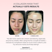 Lux Cove Kojic Acid Overnight Collagen Mask - 11