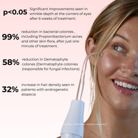 Lux Cove High Frequency Therapy Wand - 4
