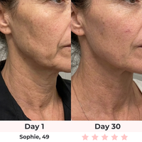 Lux Cove 7-in-1 LED Facial Sculptor - 4
