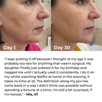 Lux Cove 7-in-1 LED Facial Sculptor - 5